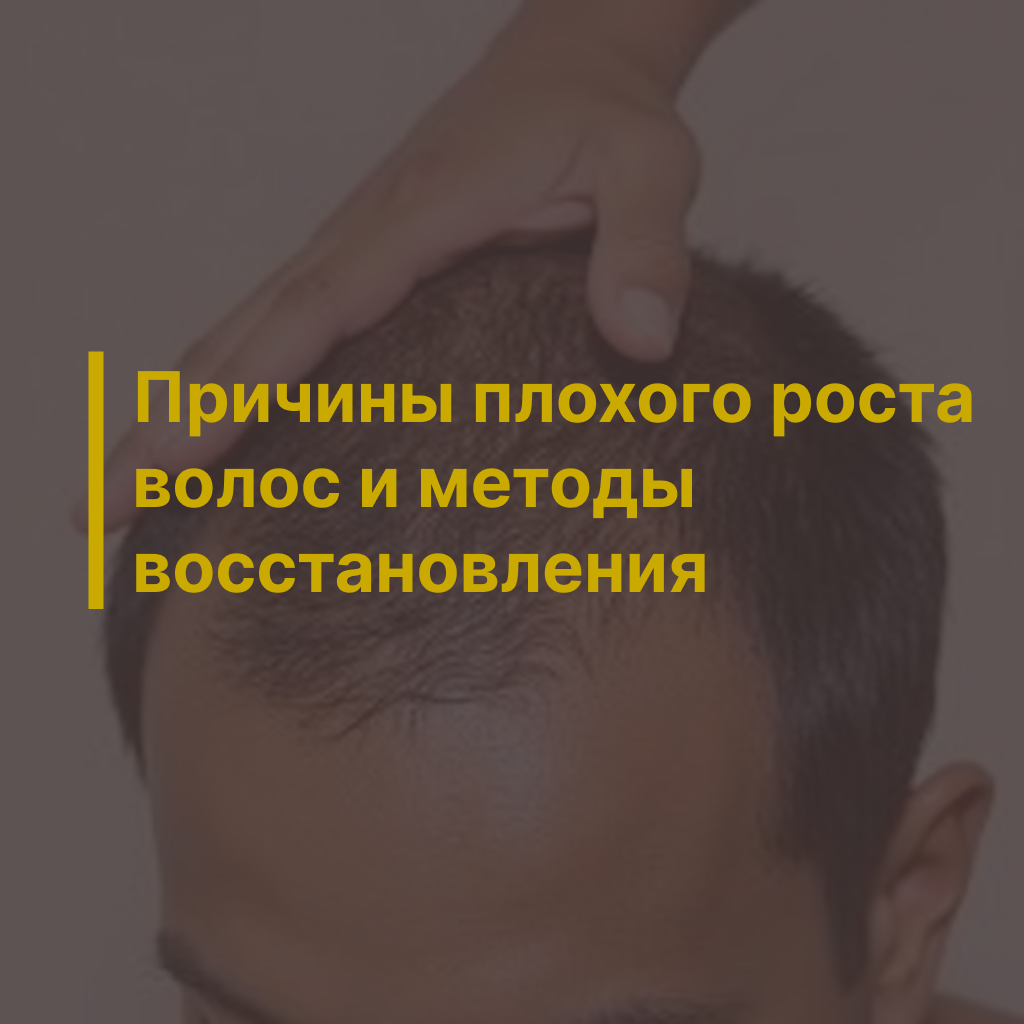 Причины плохого роста волос и методы восстановления