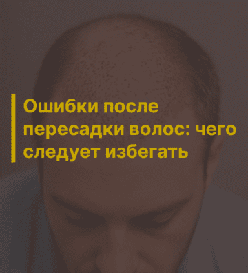 Ошибки после пересадки волос: чего следует избегать