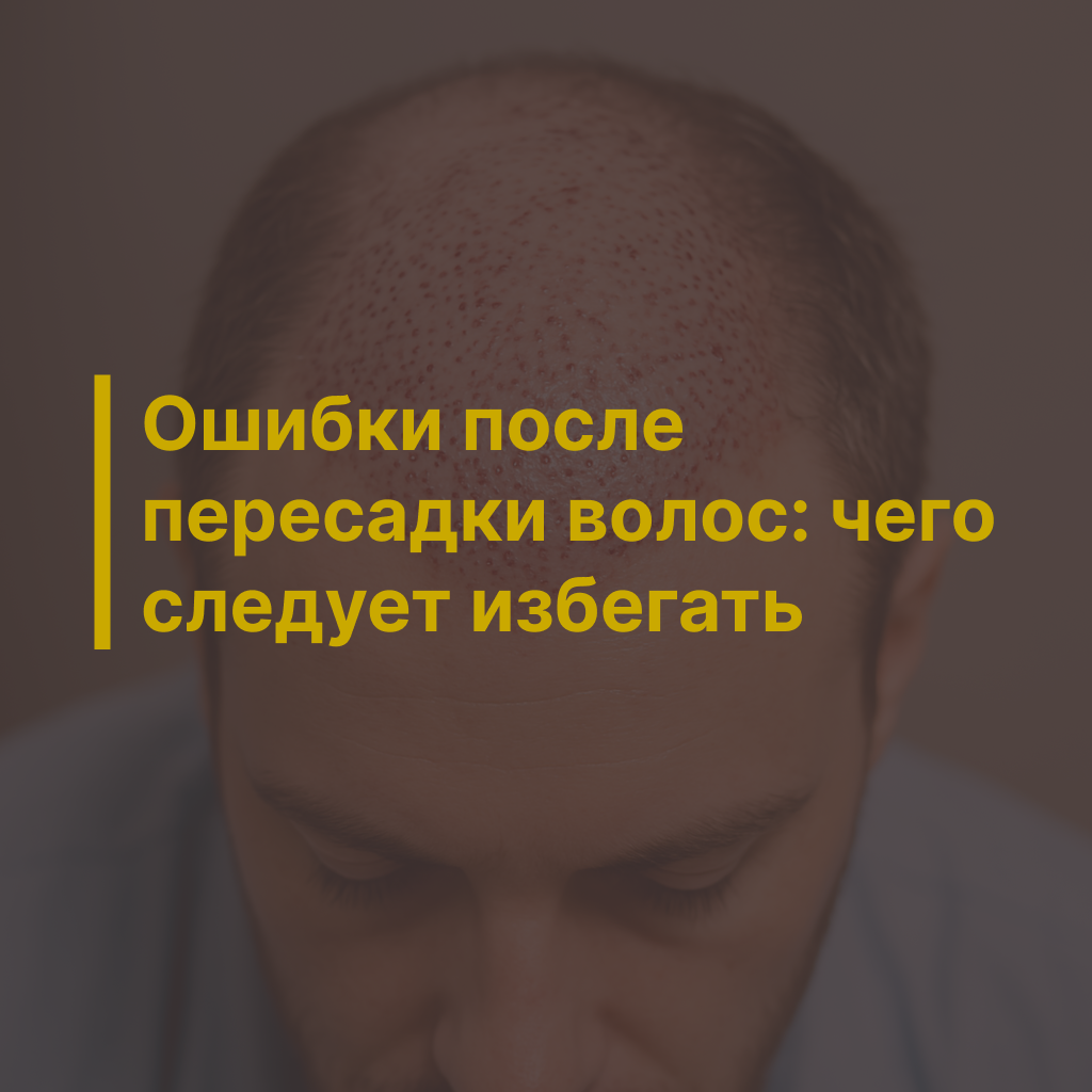 Ошибки после пересадки волос: чего следует избегать