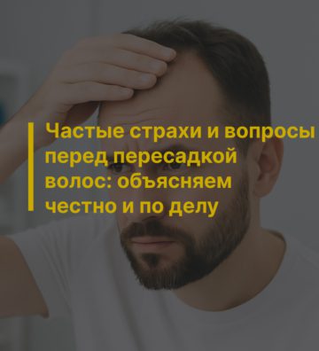 Частые страхи и вопросы перед пересадкой волос: объясняем честно и по делу