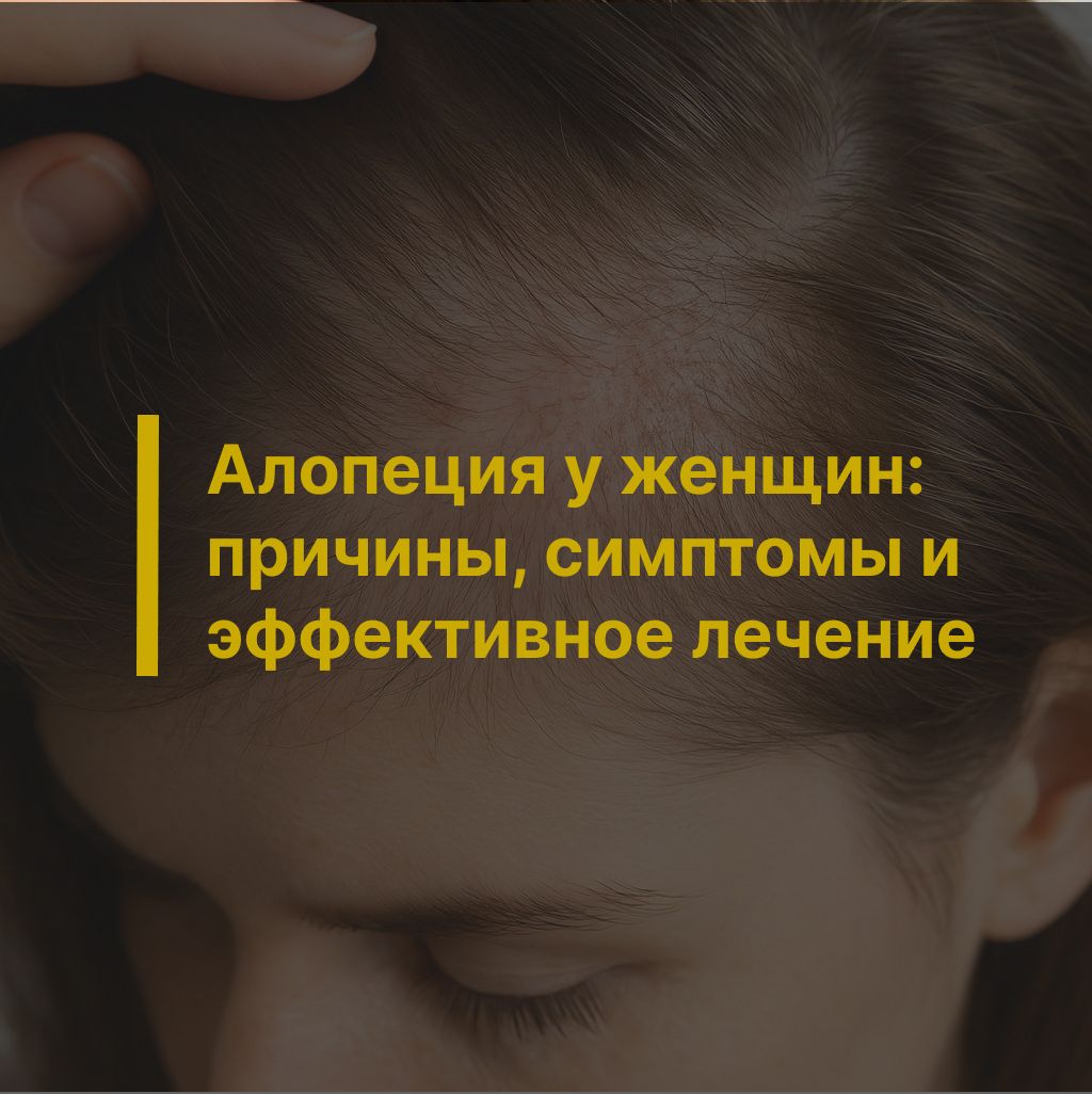  Алопеция у женщин: причины, симптомы и эффективное лечение