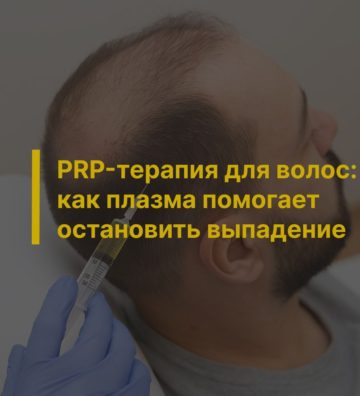 PRP-терапия для волос: как плазма помогает остановить выпадение