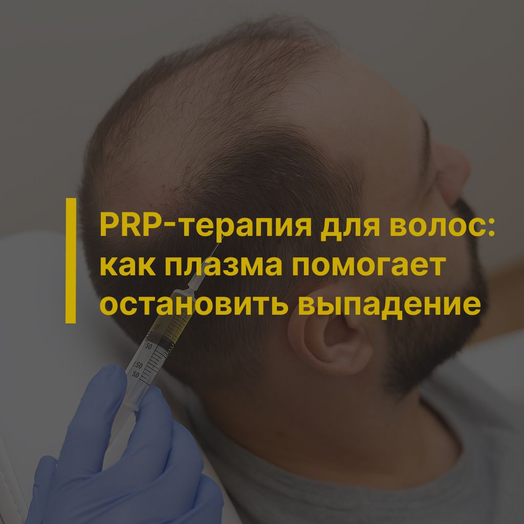 PRP-терапия для волос: как плазма помогает остановить выпадение