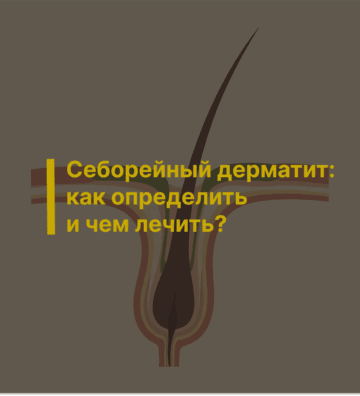 Себорейный дерматит: как определить и чем лечить?