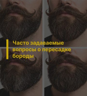 Часто задаваемые вопросы о пересадке бороды
