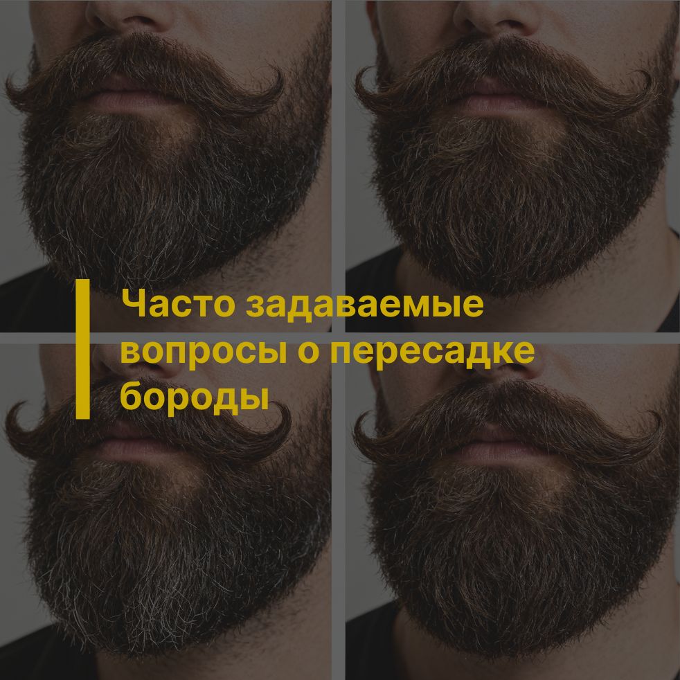 Часто задаваемые вопросы о пересадке бороды