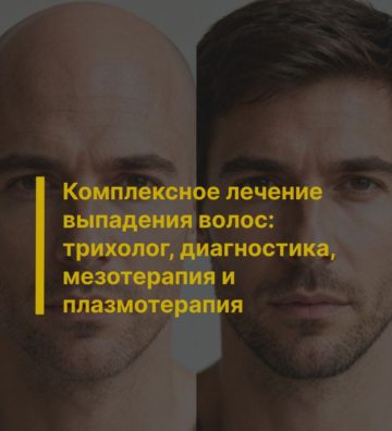Комплексное лечение выпадения волос: трихолог, диагностика, мезотерапия и плазмотерапия